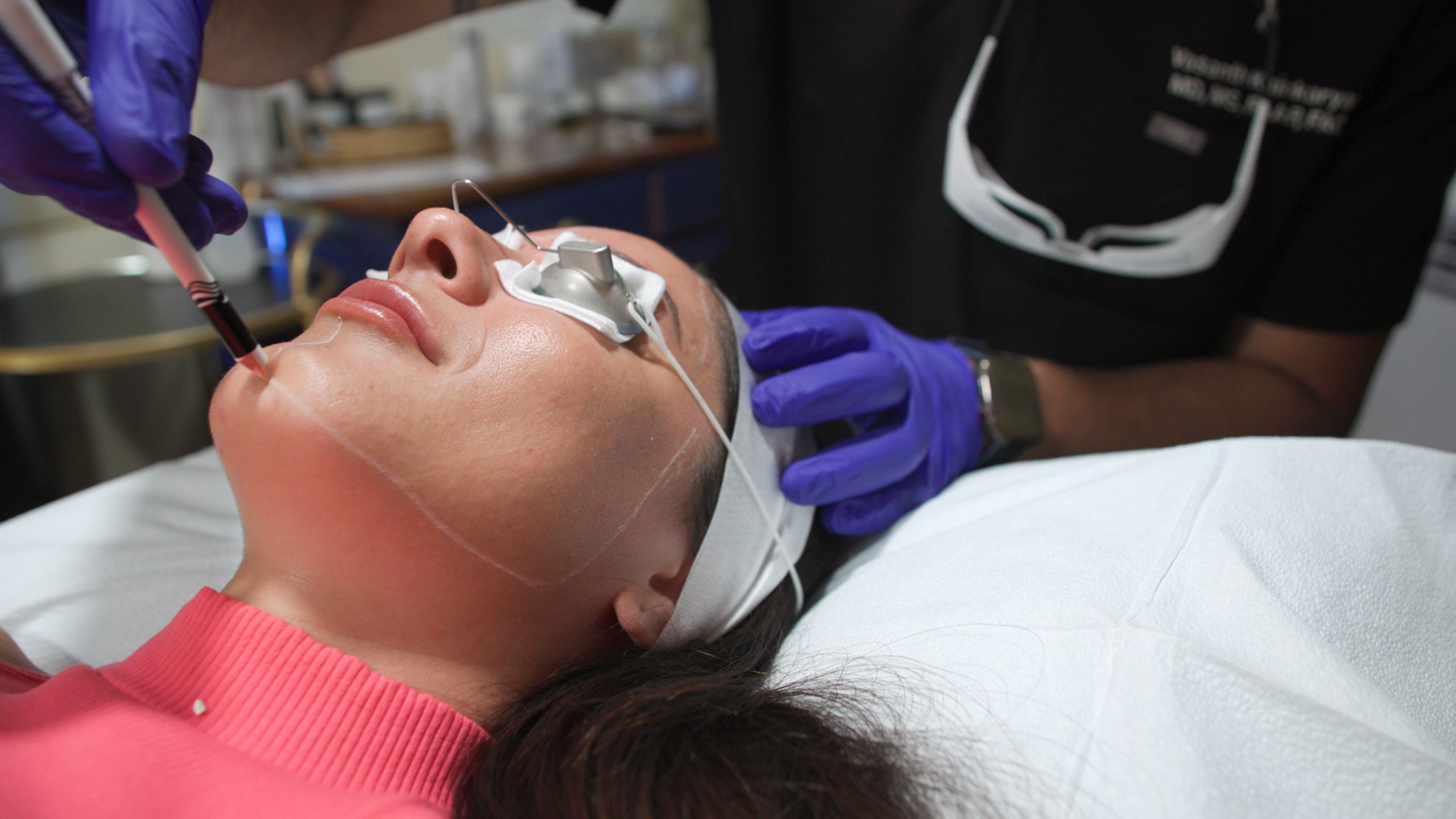 Laser Genesis Facial